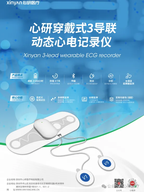 穿戴式设备
