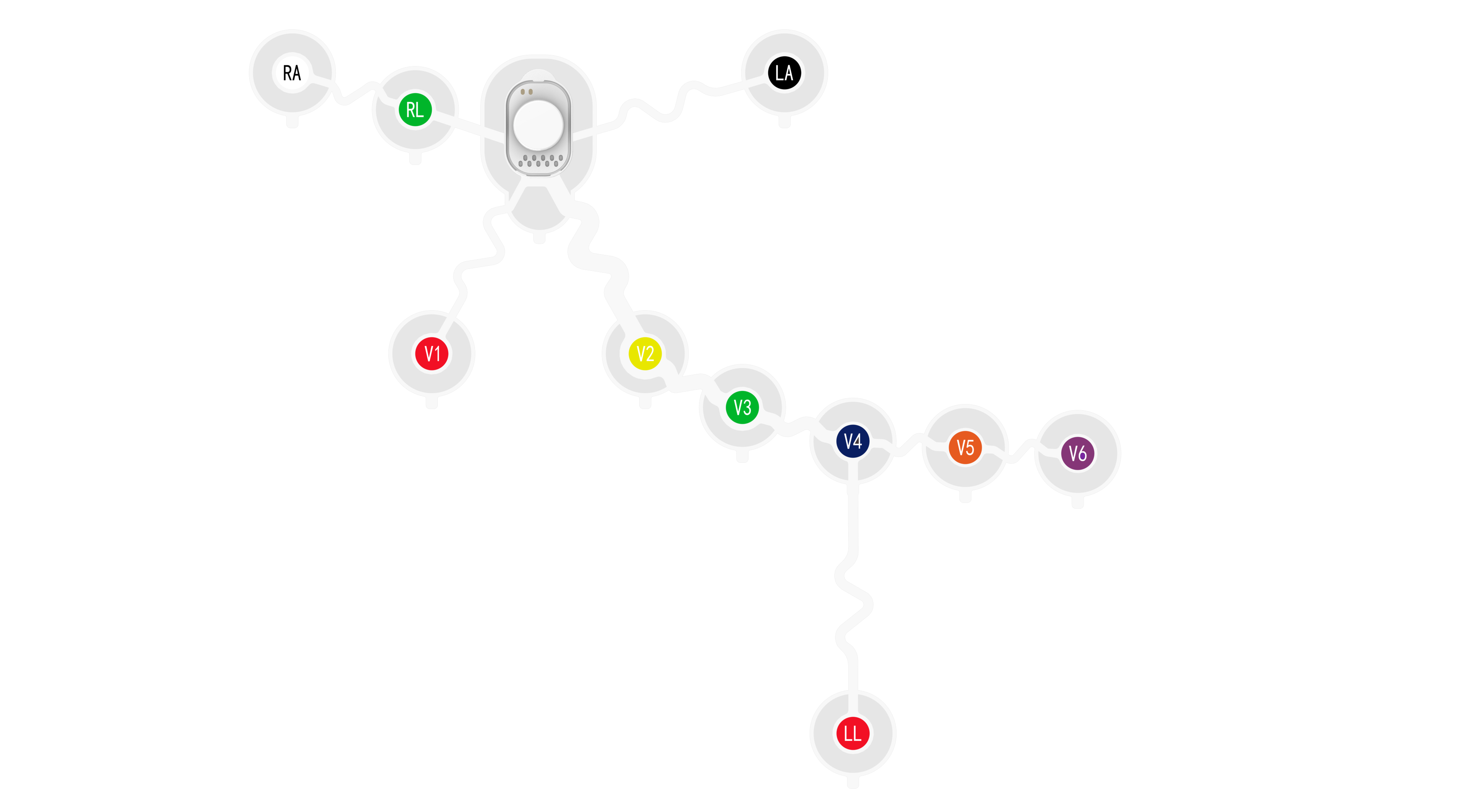 12导穿戴式心电传感器